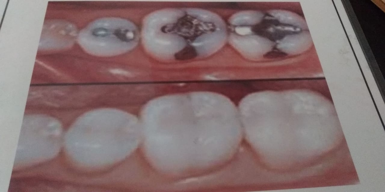 Maruthi Dental Clinic - Dr Arun